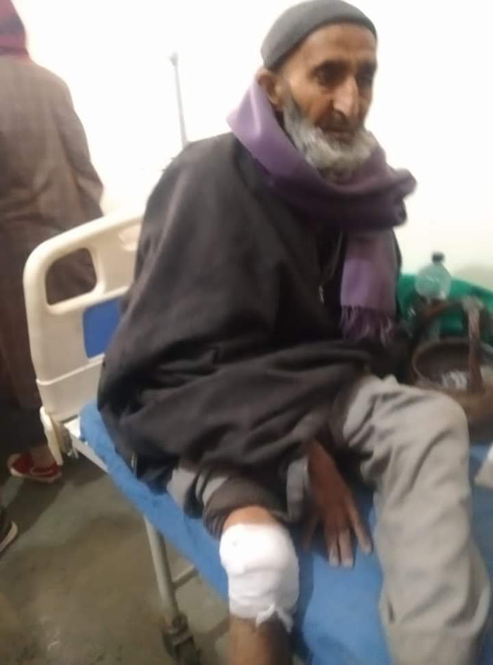 Man who suffered minor injuries in Tral grenade blast dies at home, police says death natural