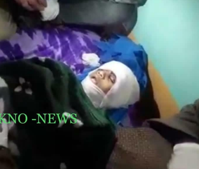 8-yr-old boy mauled to death by street dogs in Pulwama