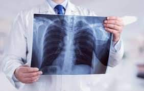 X-Ray Facility at Anantnag Hospital Defunct From Last 5 Days