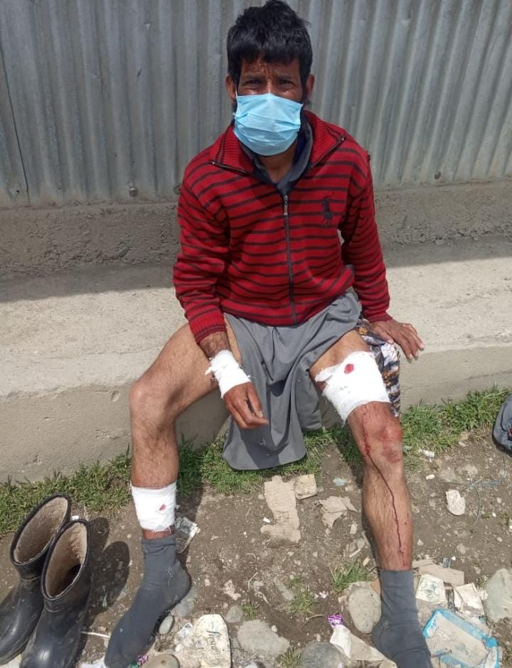 Stray dog on prowl in Bandipora village, 06 bitten in a single day