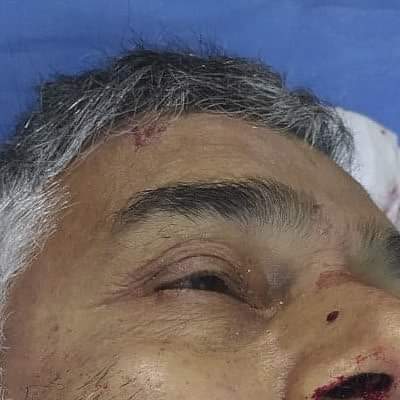 One dead, another injured in Sopore road mishap