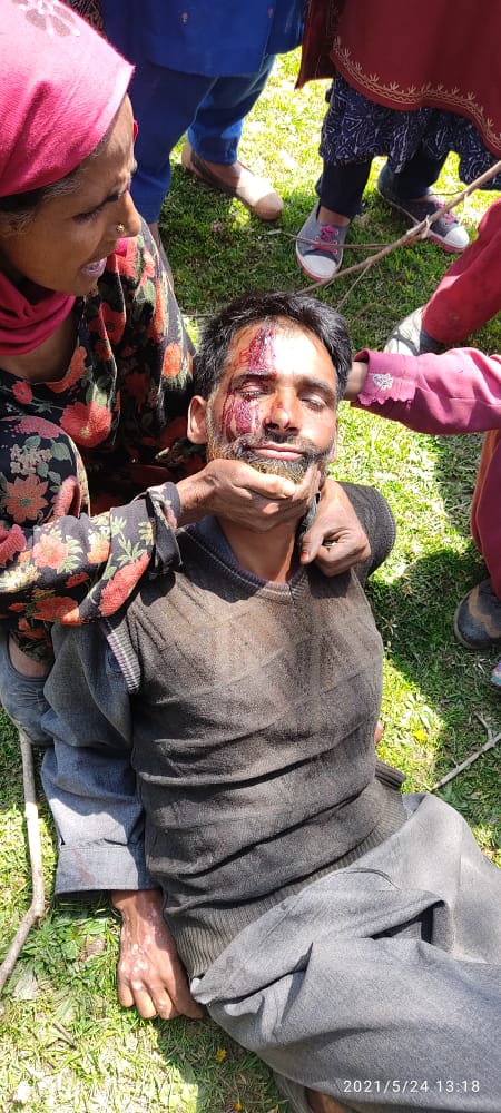 Eviction drive turns violent in South Kashmir’s Shopian Several people including forest employees injured