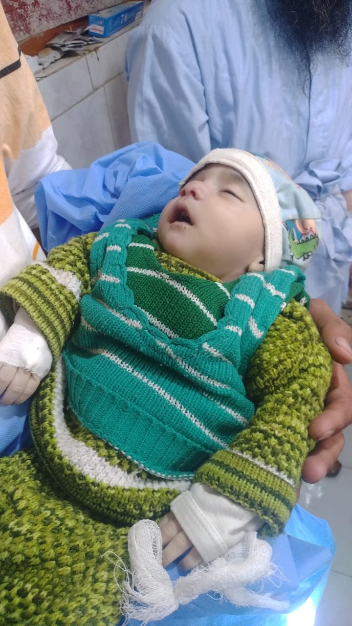 After immunization 45 days old baby dies in Central Kashmir’s Budgam ‘Baby dies of convulsion disorder: BMO