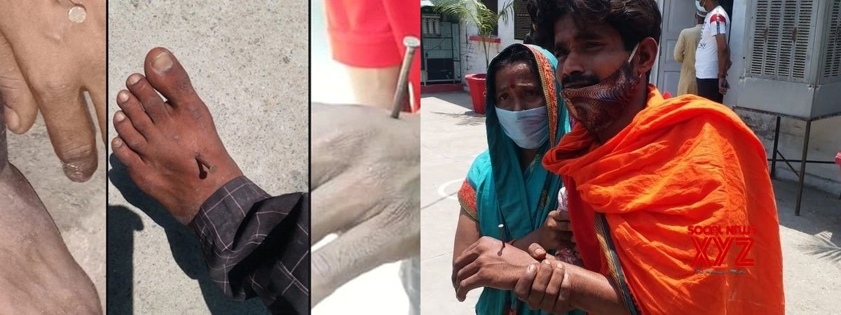 Man claims police hammered nails into his hand, foot but police denies