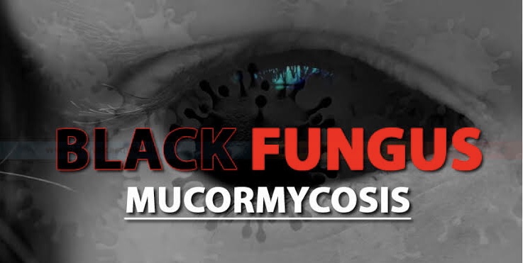 This year’s first suspected case of Black Fungus admitted at GDC Sgr