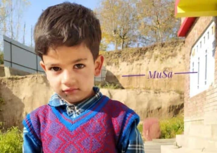 Two days after falling off slab, Kulgam minor boy succumbs at SKIMS