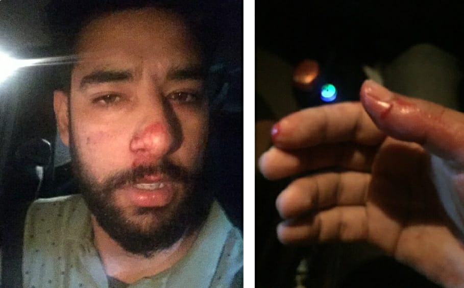 Journalist allegedly beaten by cops on National Highway in Anantnag