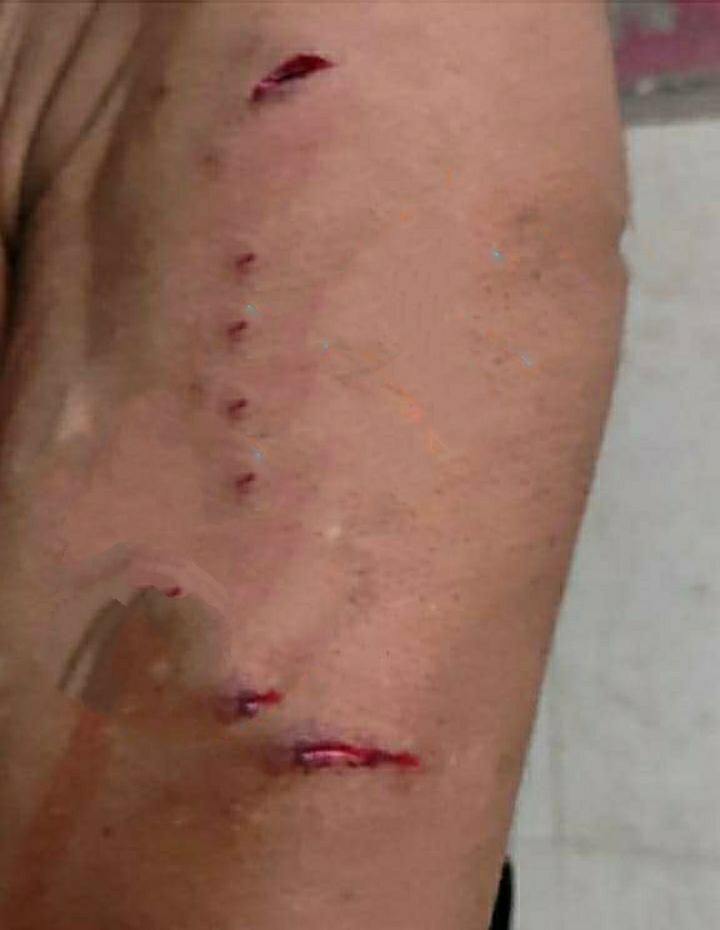 Elderly Man Injured In Leopard Attack in Anantnag
