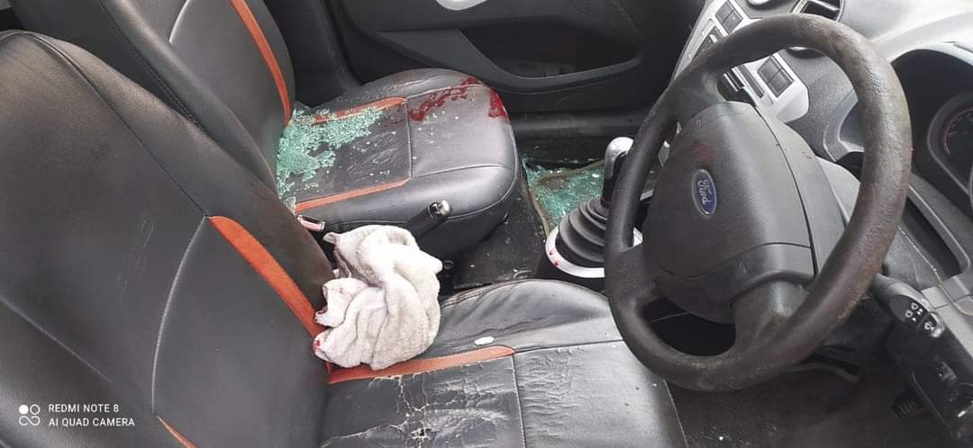 Militants attack police party in Khanyar, Cop, civilian injured