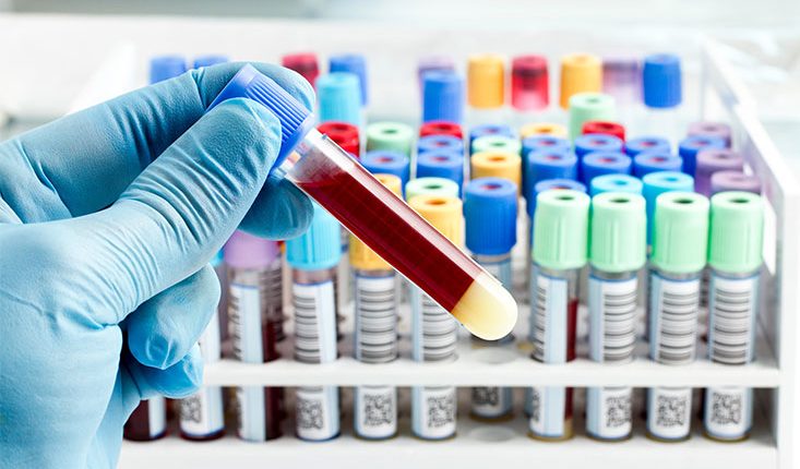 Long pending demand of Bandiporians resolved as Blood Bank finally got Govt. approval  
