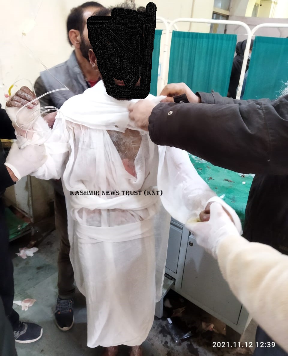 Young man attempts suicide by setting self on fire in Tral