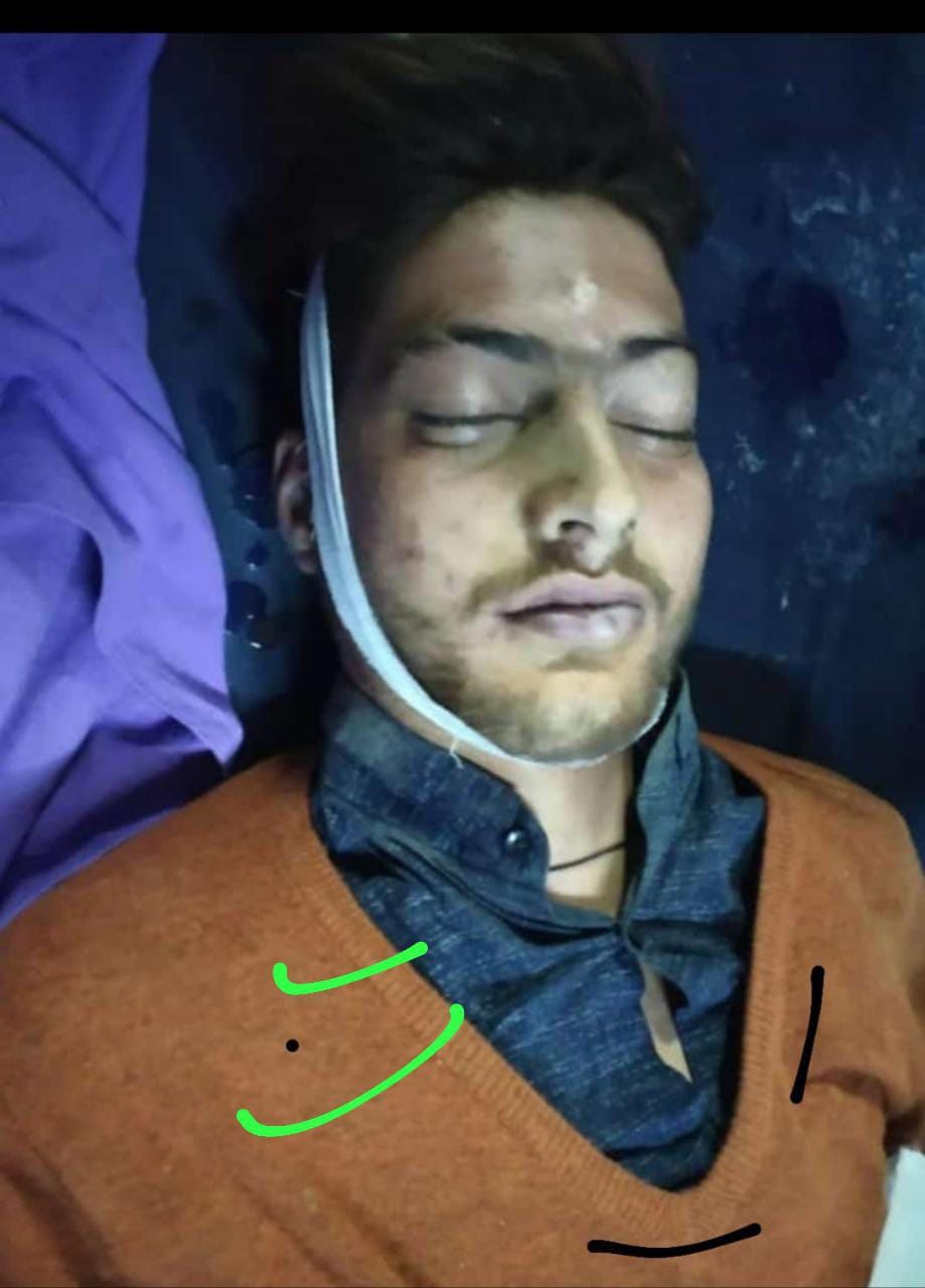 Youth killed in road mishap in Baramulla village