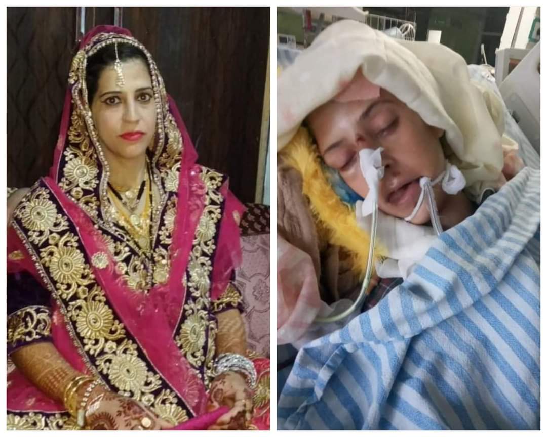 Baramulla Woman Allegedly Beaten By In-laws Succumbs at SKIMS Soura