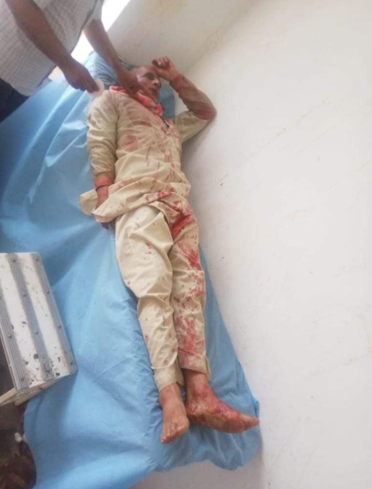 Jal Shakti Department Employee Critically Injured in Leopard Attack in Handwara No Equipments, Manpower at Hand to Catch the Beast: Wildlife Department Official