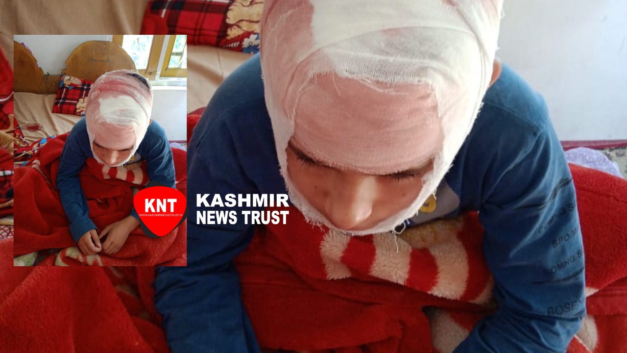 Beaten up by teacher class 5 student receives four stitches on head in Kashmir