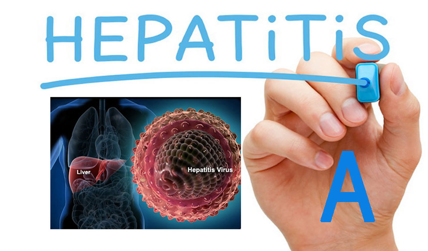 Several cases of Hepatitis-A reported in Shopian village