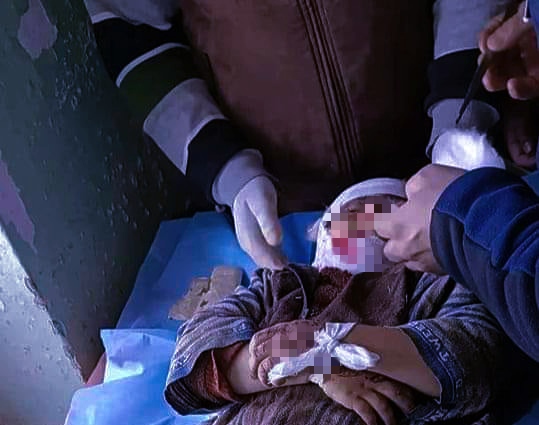 5-yr-old girl dies in Kulgam accident