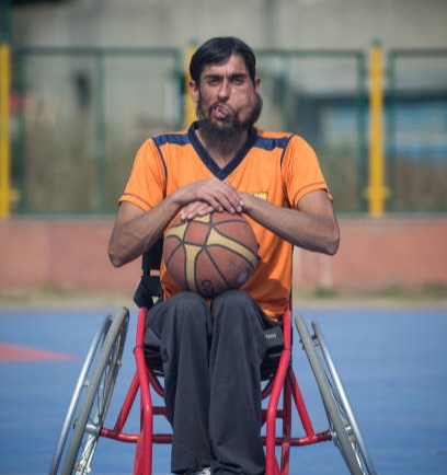 Meet Mohammad Rafee, the man with facial hemangioma, spinal injury ‘but’ plays nationals in wheelchair baskets