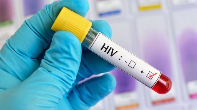 AIDS on rise as J&K records 6,158 HIV-positive cases this year so far