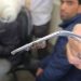 GMC Anantnag Doctors Remove Snake-Like Worm from Teenager’s Nostril